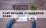 手上起了白斑怎么回事（手上起白色的斑点是怎么回事）