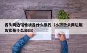 舌头两边锯齿状是什么原因（小孩舌头两边锯齿状是什么原因）